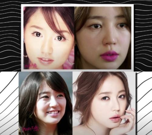 korean stars plastic surgery before and after
