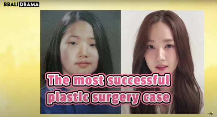 park min young plastic surgery ruined acting