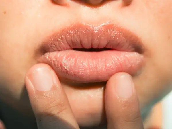 Is Lip Balm Actually Making Your Dry Lips Worse? We Asked an Expert for Advice